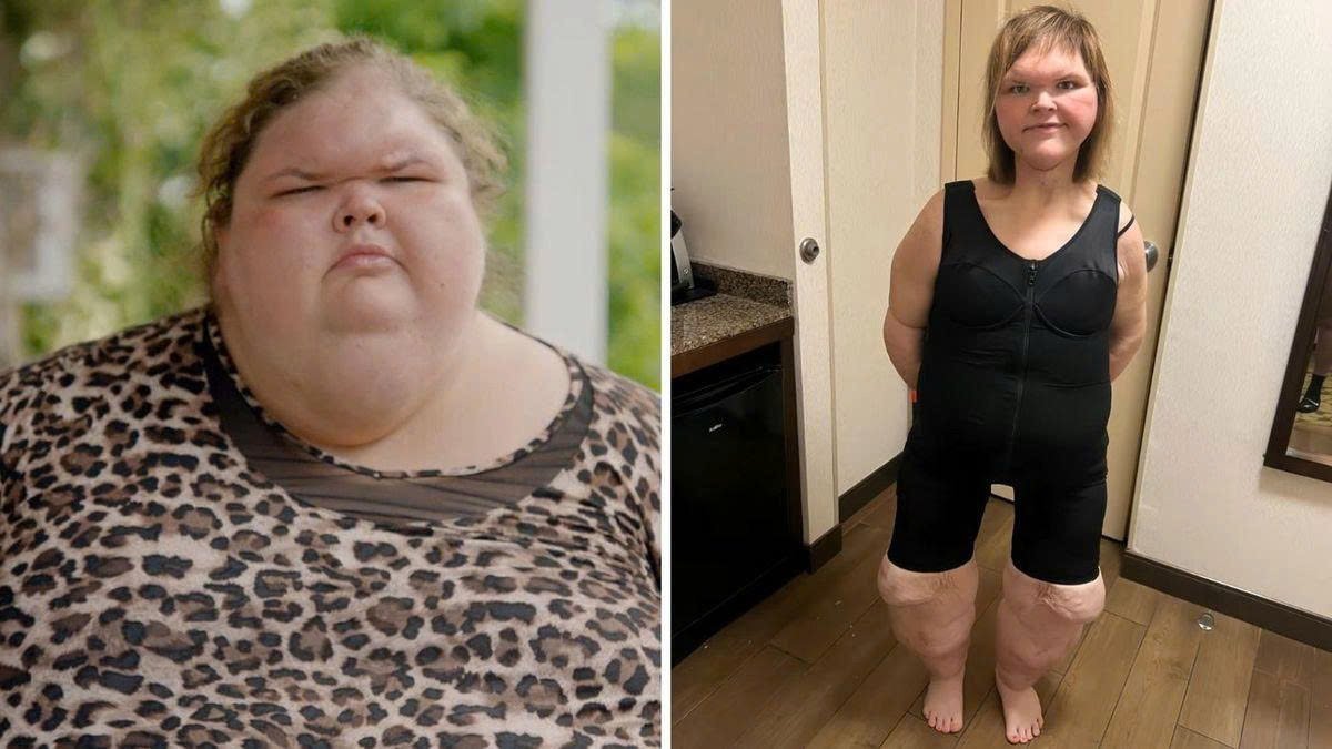 Amy Slaton before and after weight loss transformation
