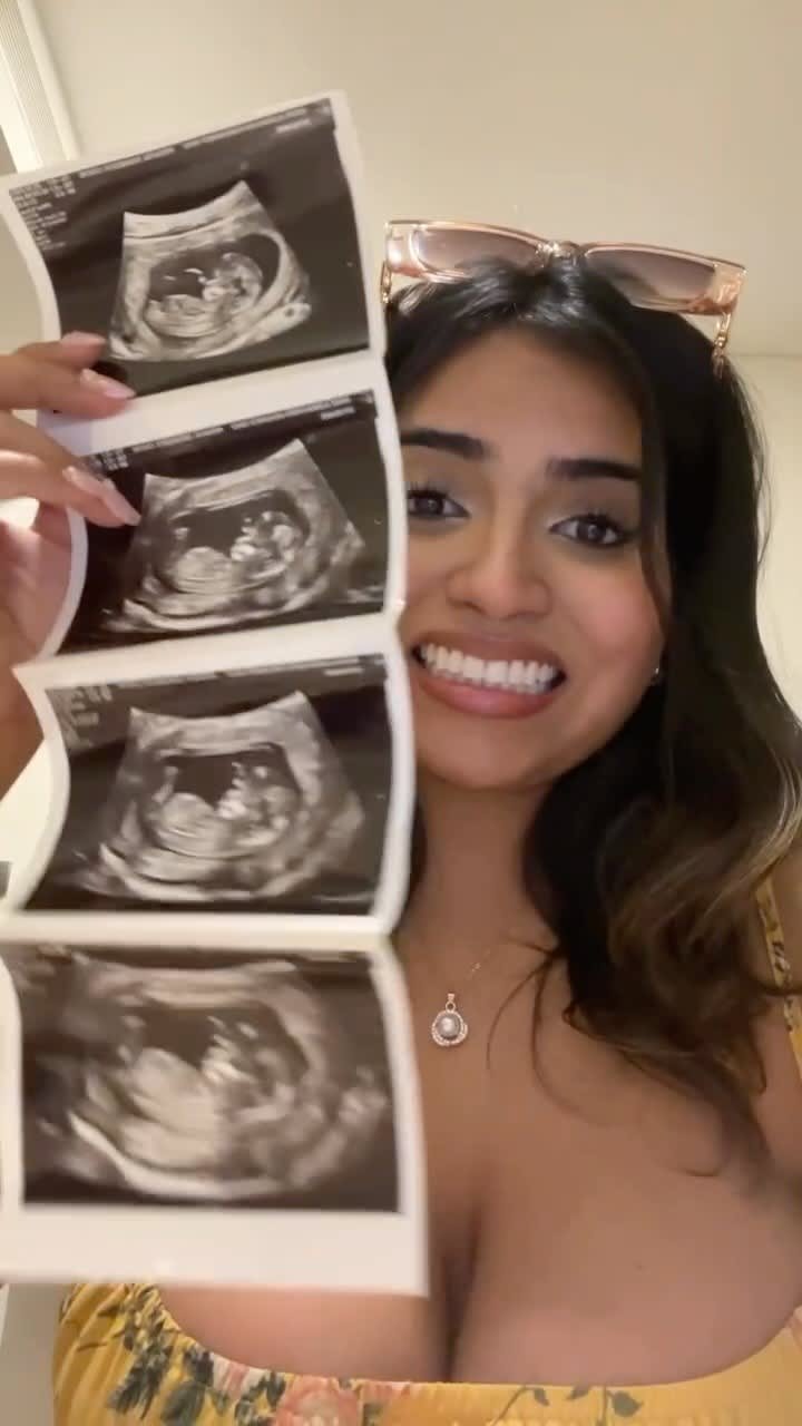 Ally shows her ultrasound photos
