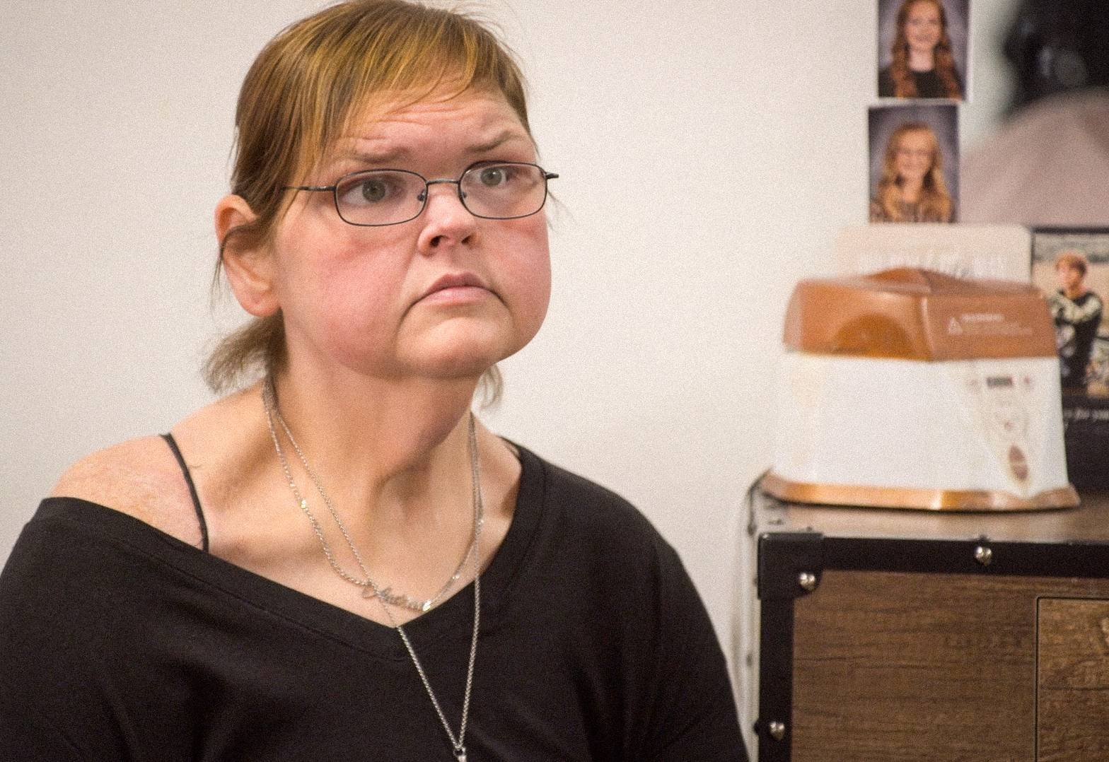 Tammy Slaton after sk in removal surgery
