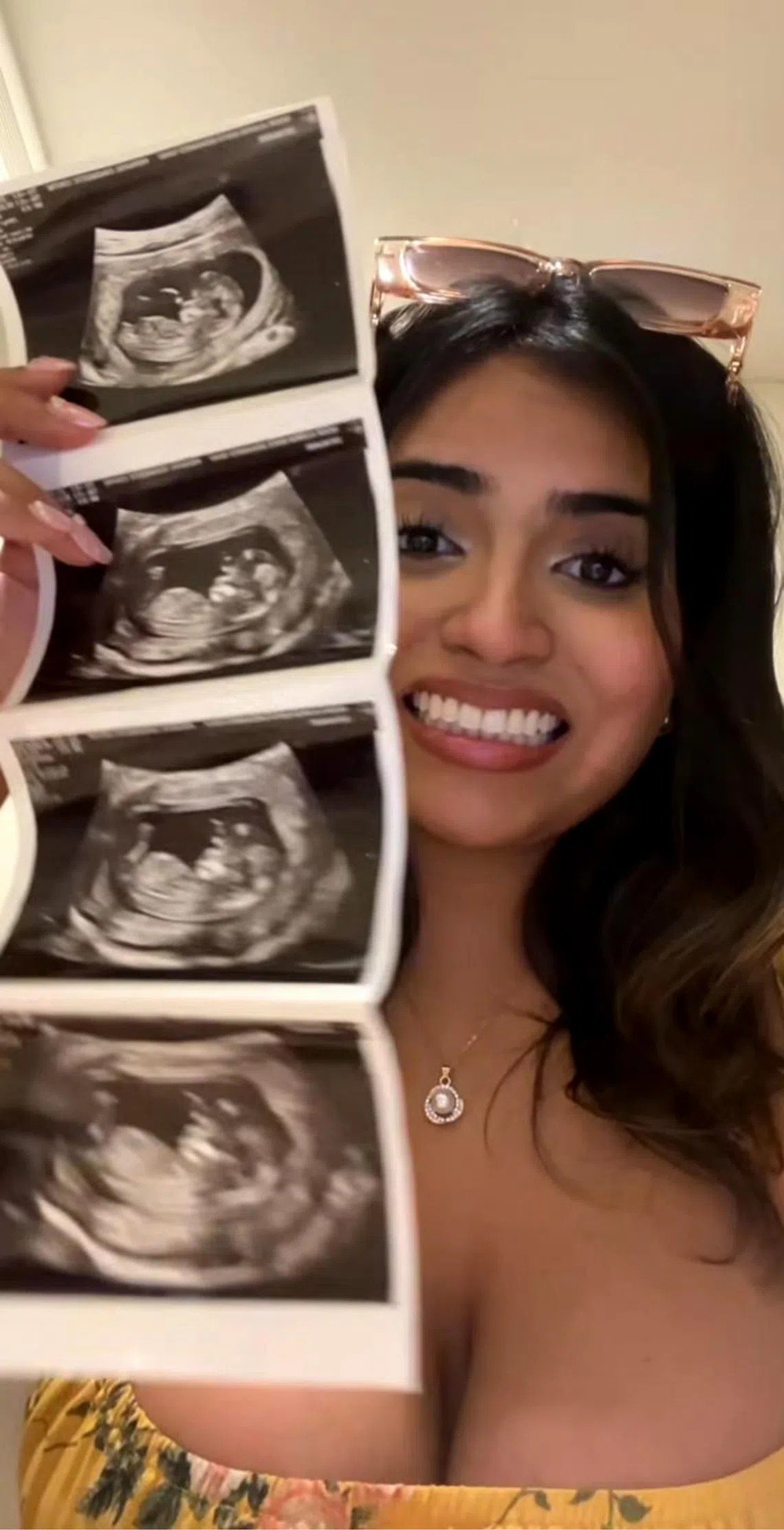 Ally smiling and holding up her ultrasound photos