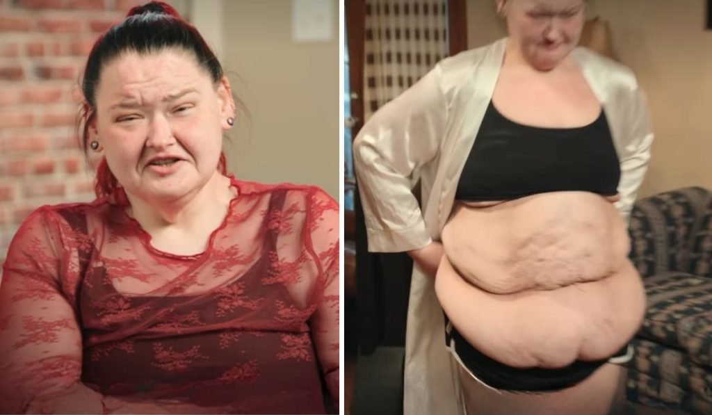 Amy Slaton loose skin Season 9 trailer