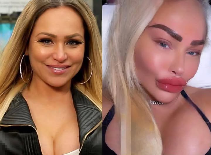 Darcey Silva before and after her filler era