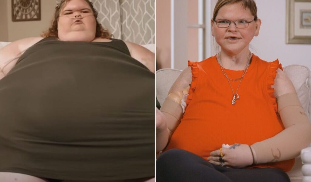 Tammy Slaton before and after skin removal surgery