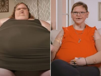 Tammy Slaton before and after skin removal surgery